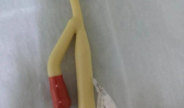 膀胱冲洗操作视频,步骤与技巧全解析